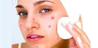 अनुहारमा स–साना प्वालहरु हटाउन अपनाउनुस् यी घरेलु उपाय