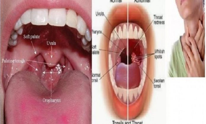 ghati-kharab-tonsil