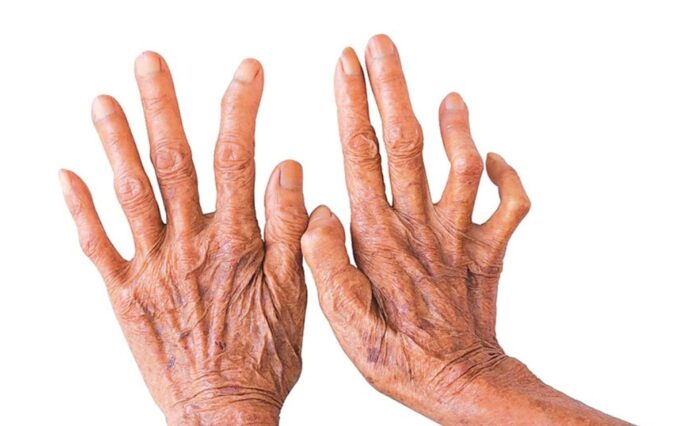 Hand nail